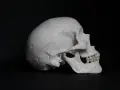 Model ludzkiej czaszki z widocznym nacięciem, sugerującym trepanację czaszki.