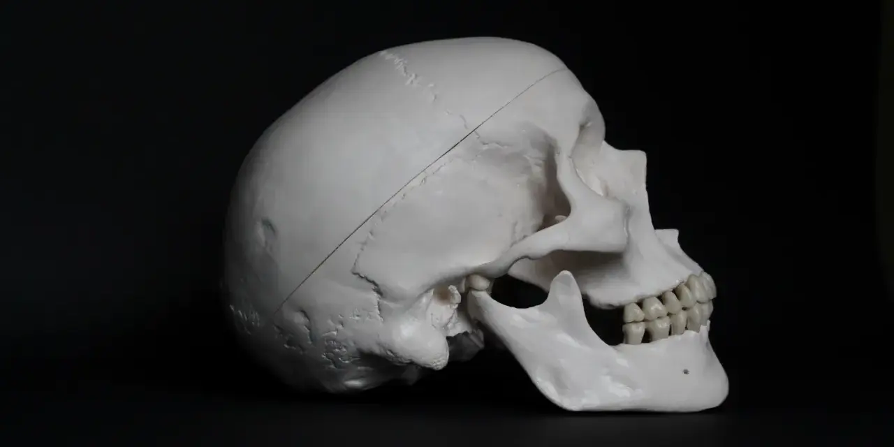 Model ludzkiej czaszki z widocznym nacięciem, sugerującym trepanację czaszki.