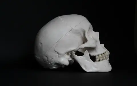 Model ludzkiej czaszki z widocznym nacięciem, sugerującym trepanację czaszki.