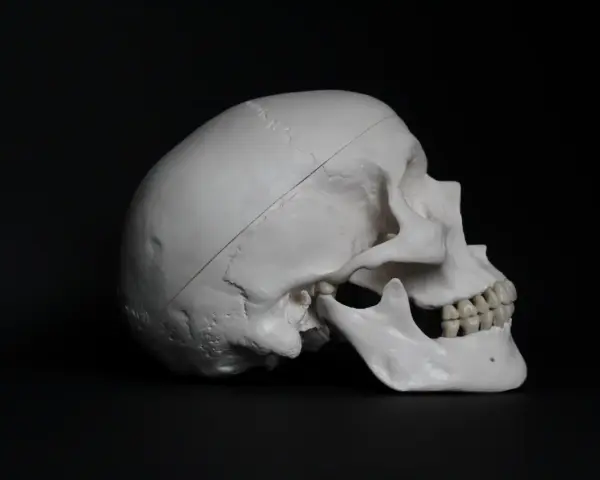 Model ludzkiej czaszki z widocznym nacięciem, sugerującym trepanację czaszki.